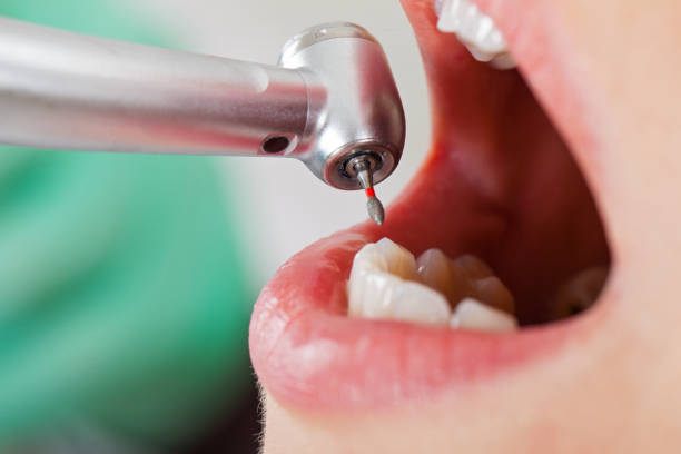 Best Emergency Treatment for Jaw Pain or Injury in Duarte, CA